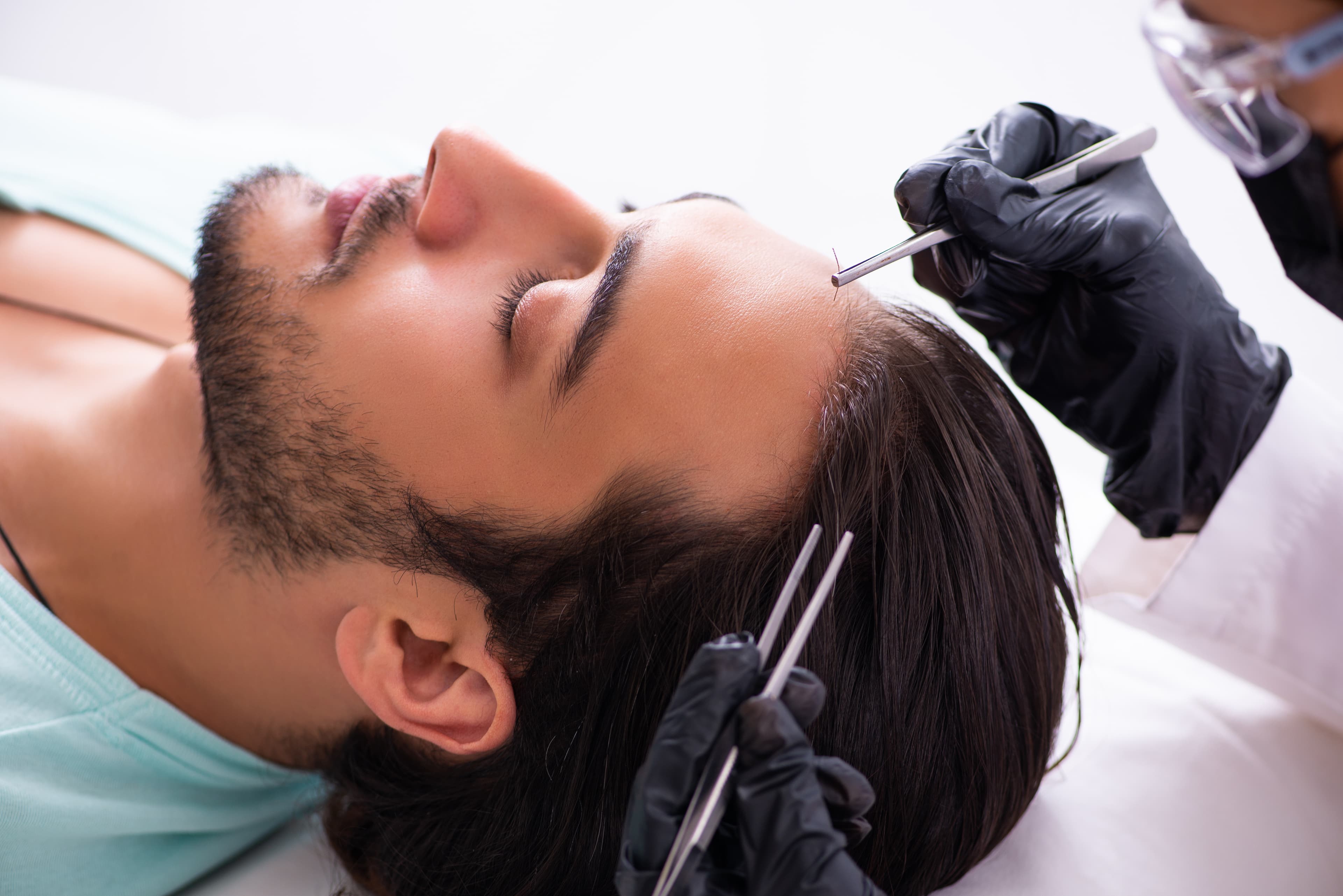Invisigraft Hair Transplant Procedure