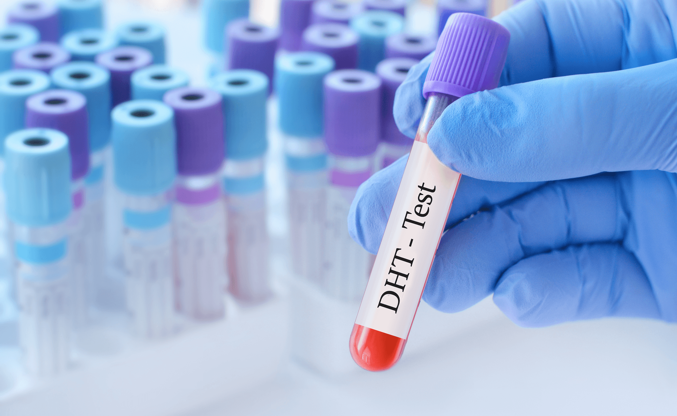 Understanding DHT And Hair Loss