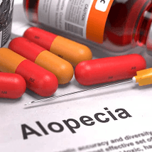 Understanding Alopecia: Causes, Types, and Treatment Options
