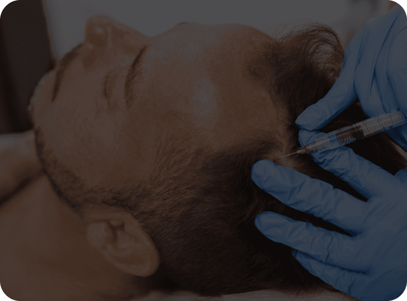 Exosome Therapy