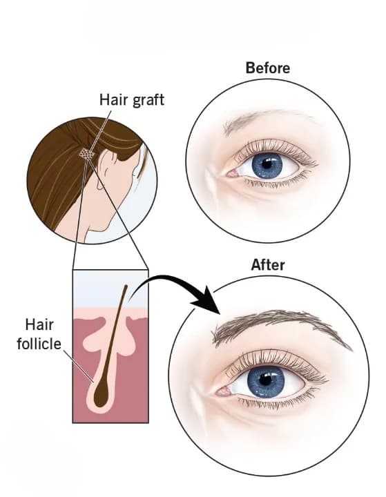 How EyeDefine Works