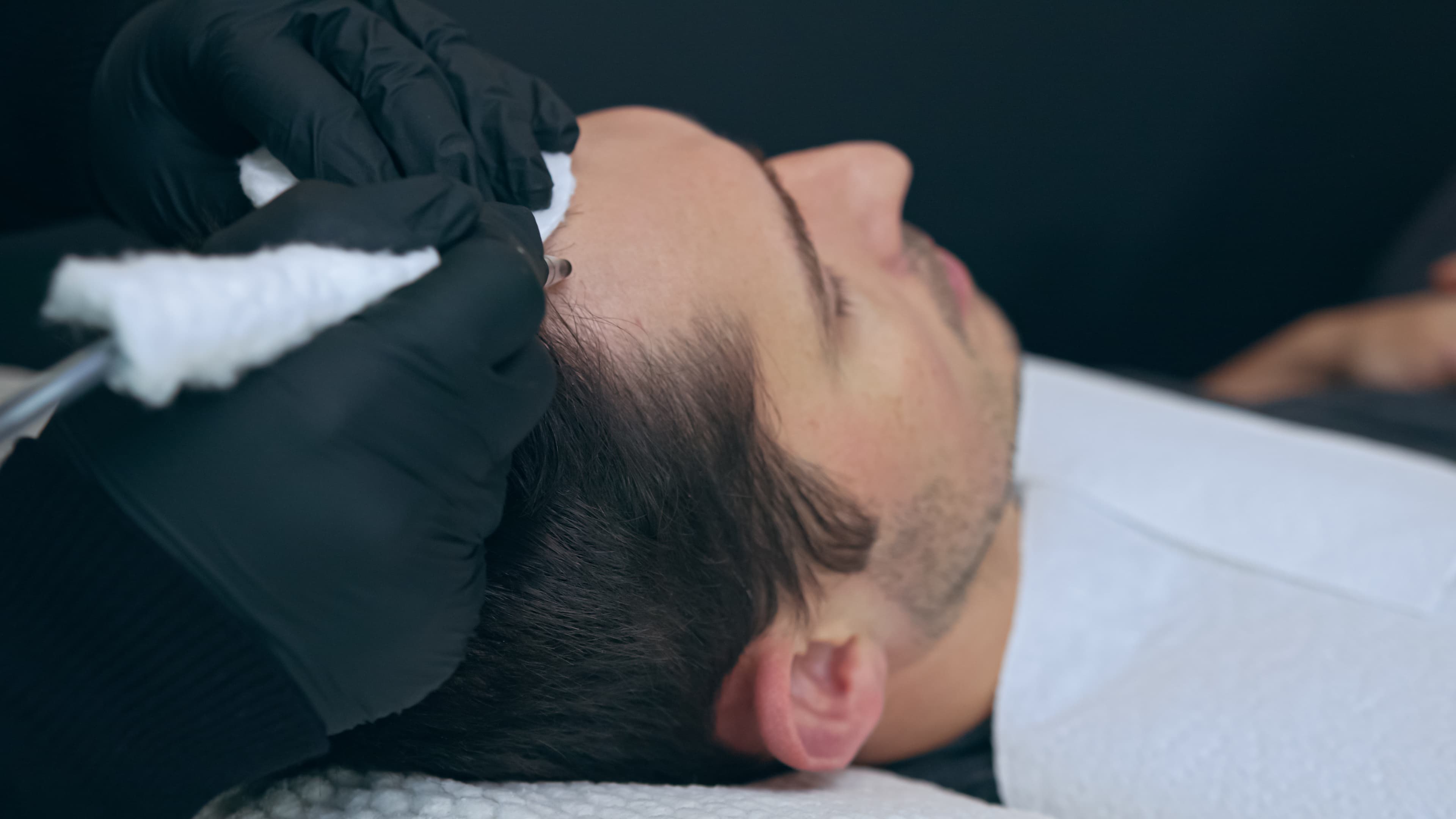 Hair Loss Medication demonstration