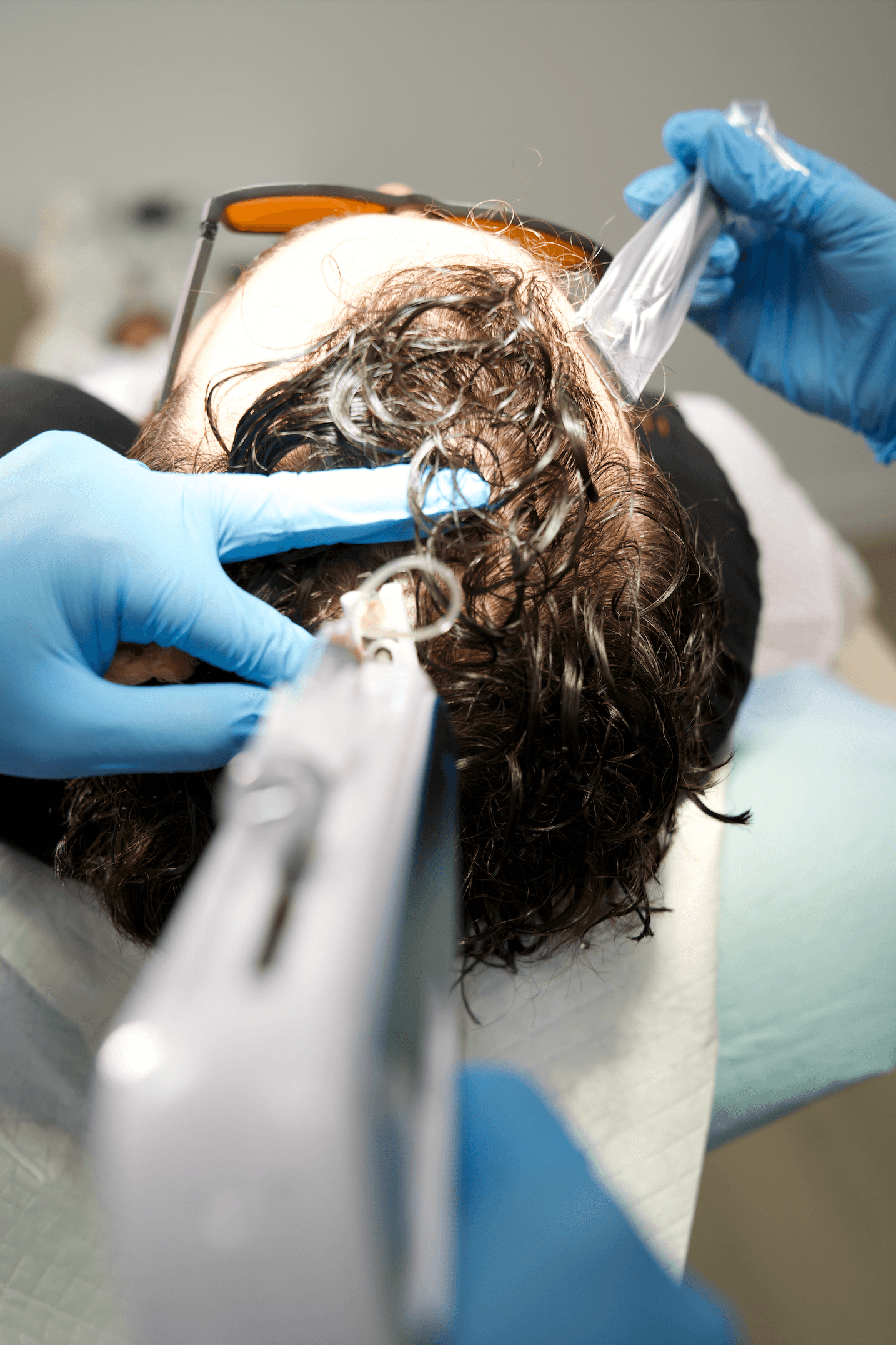 The Benefits of Exosome Hair Therapy