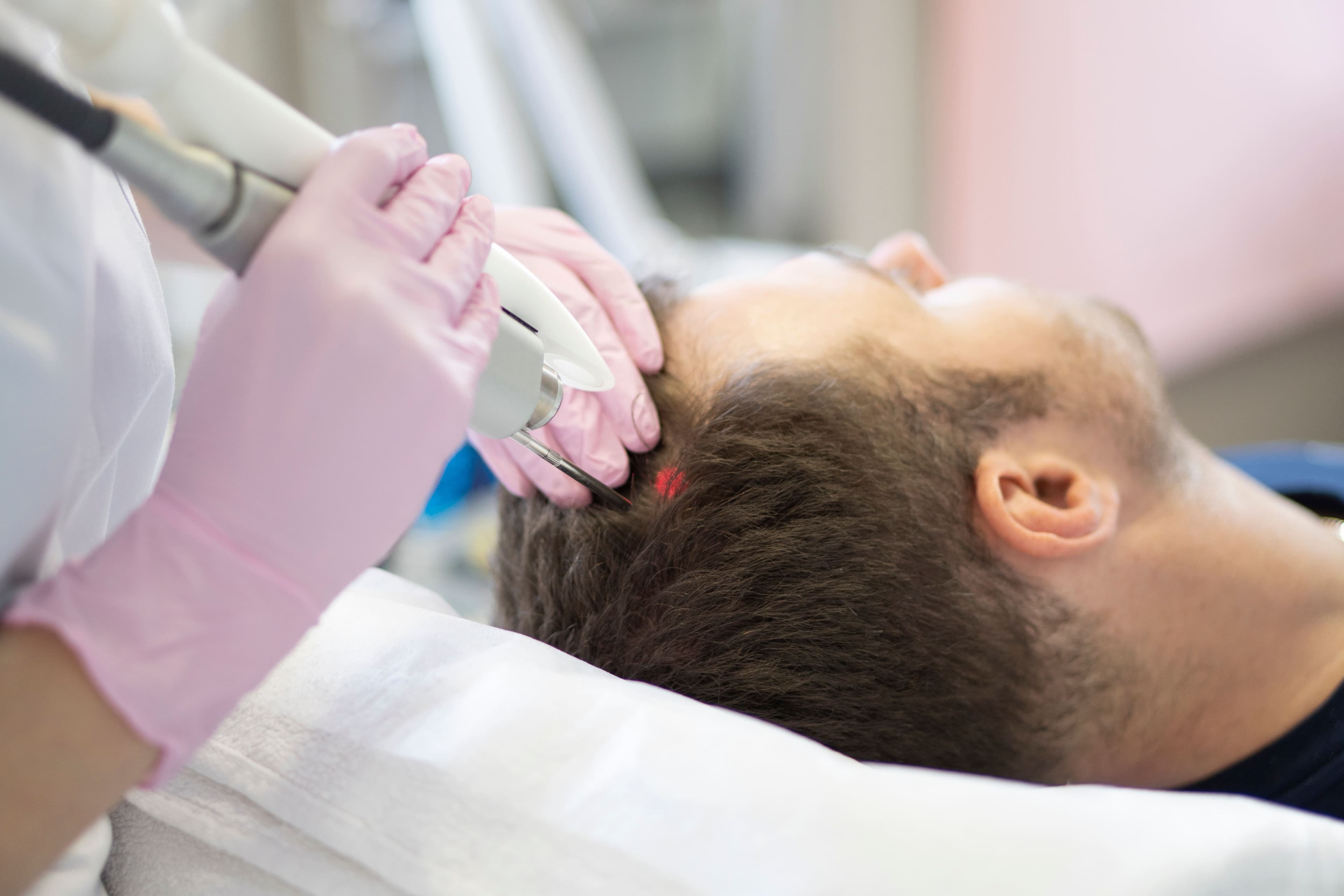 Fractional Laser For Hair Loss | Hair Growth Laser Treatment | Male & Female Non-Surgical Hair Growth Options | Clinic In Hallandale Beach, Florida | Hairthetics
