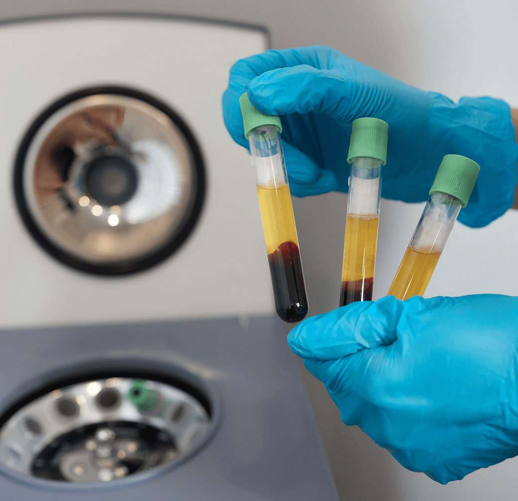 Growth Factor Therapy demonstration