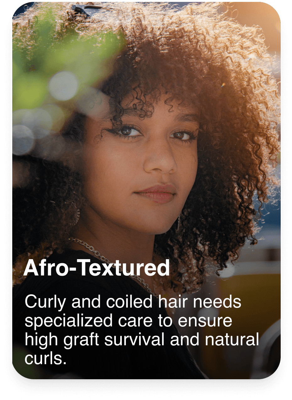 Hair transplant service 3