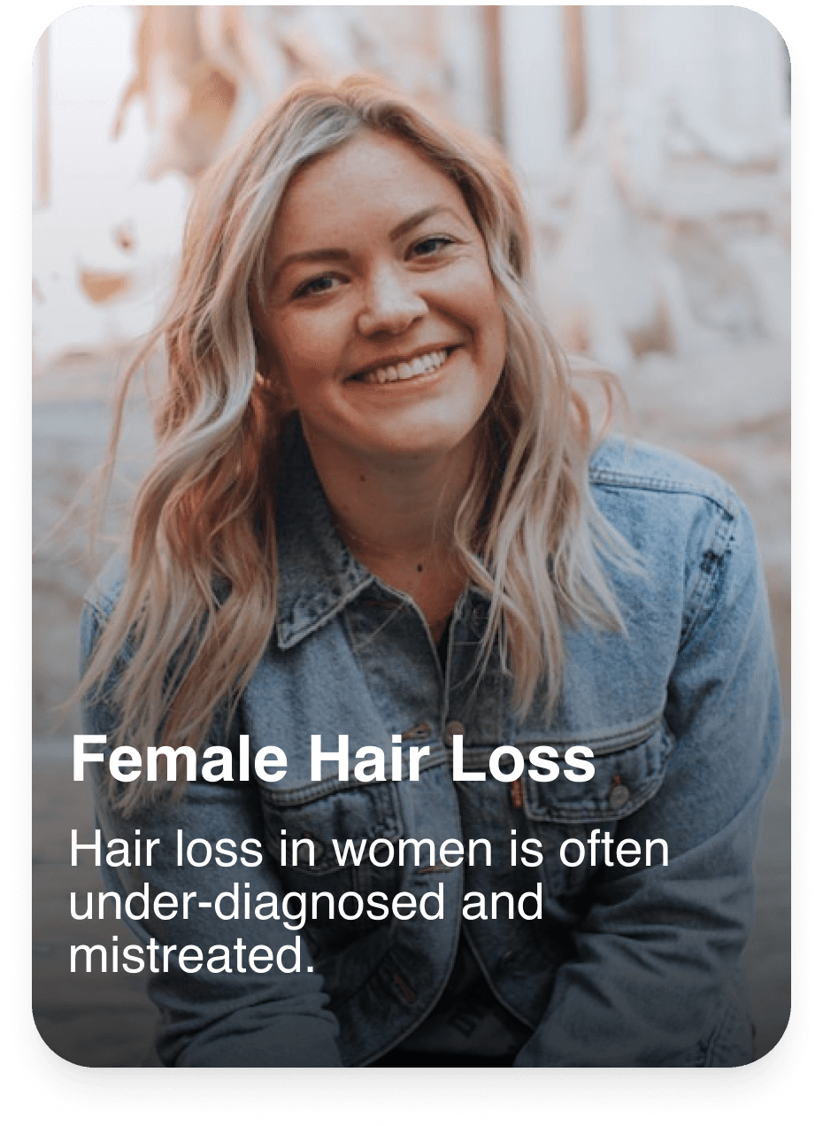 Hair transplant service 2