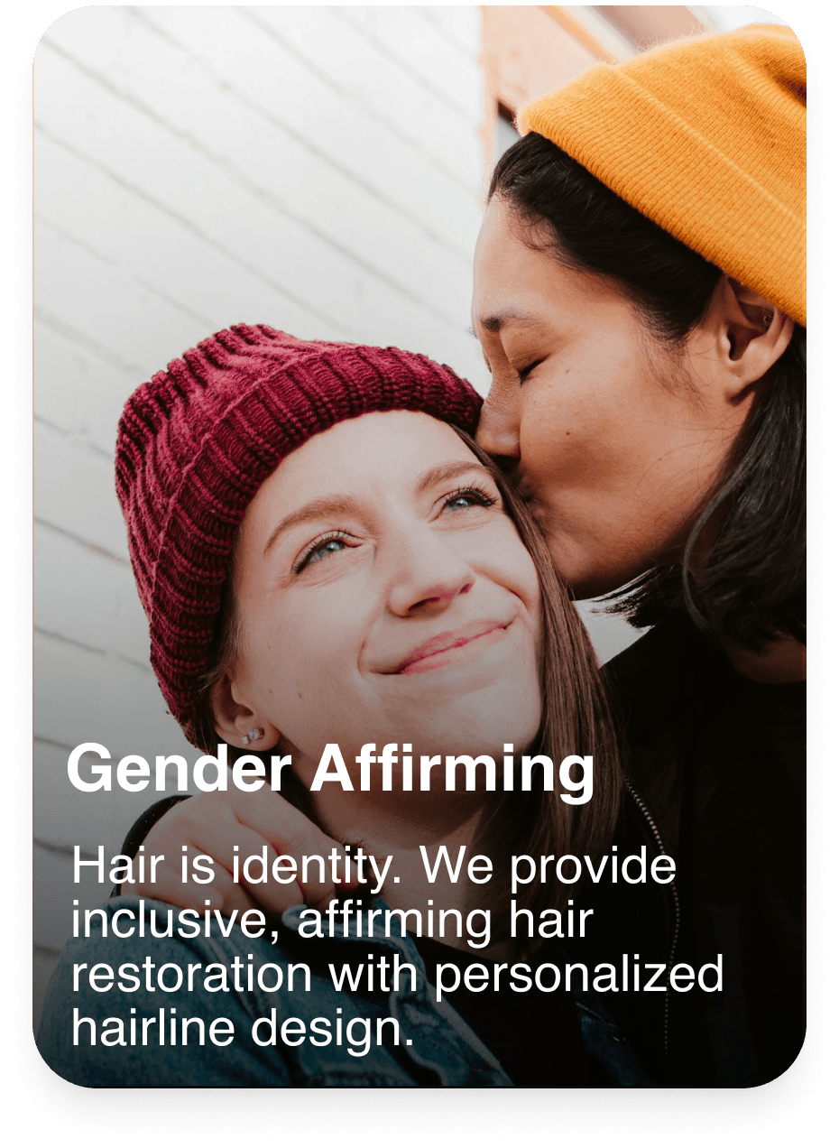 Hair transplant service 4